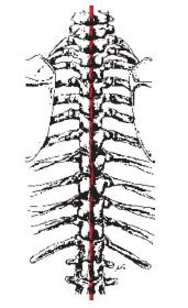 M Intertransversarii laterales Lumborum