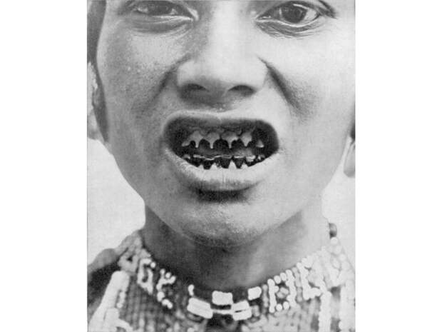 Острые зубы Ментаваи Индонезийское племя ментаваи считают заостренные зубы эталоном красоты. Чем острее и тоньше, тем более желанна женщина. Ритуал совсем не обязательный в культуре, но очень многие девочки проходят его в подростковом возрасте по собственному желанию, чтобы привлечь противоположный пол.