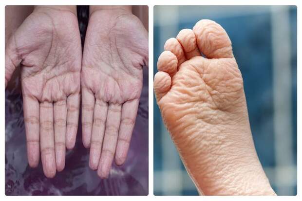 Если вы никогда не задумывались об этом, учтите, что пальцы рук и ног - единственные части нашего тела, которые сморщиваются. При длительном воздействии воды. Тогда это не может быть неотъемлемым свойством нашей кожи.