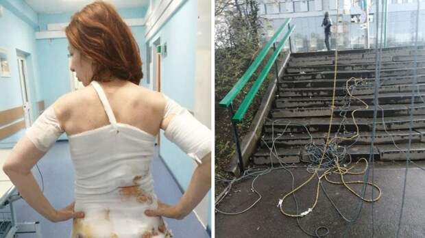 «Врачи срезали прикипевшую одежду»: на москвичку рухнули искрящиеся электропровода