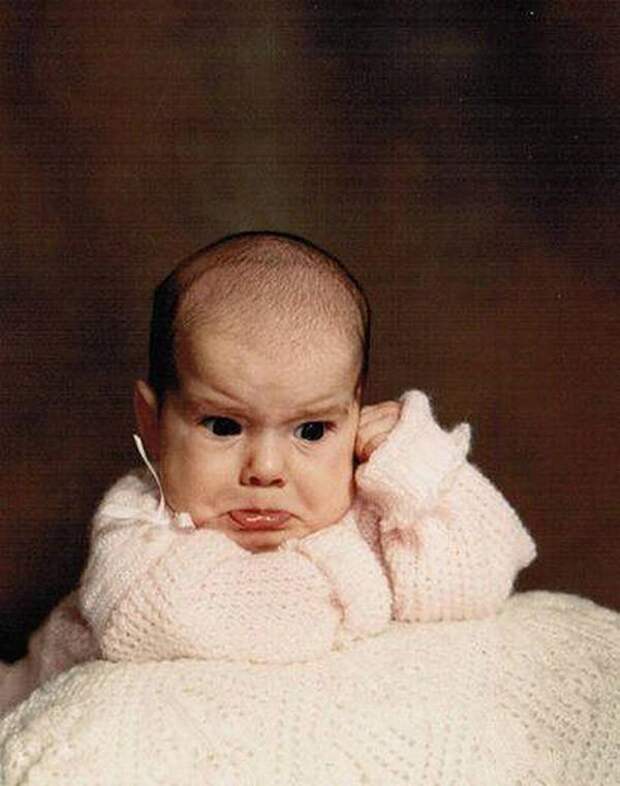 WorstBabyPhotos17 Эти ужасные младенцы