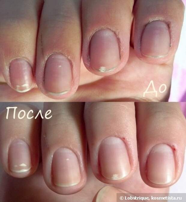 Как быстро очистить руки после огорода