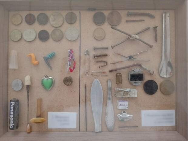 Врачи больницы Пирогова показали коллекцию предметов из желудков жителей Самары