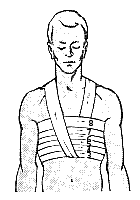 Спиральная повязка бинта нисходящая по груди фото Медтехника