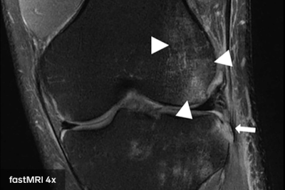 mri