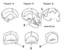 Рис. 3.7. Неандертальские признаки на черепах из пещеры Сима де лос Уэсос в Атапуэрке, Испания: 1 – среднелицевой прогнатизм, 2 – ретромолярный пробел, 3 – зачаточная надынионная ямка. 							Источник: Klein 1999